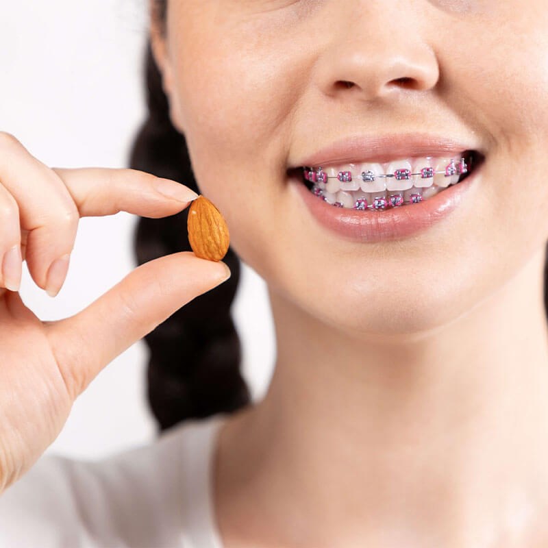 Woman with braces holding an almond